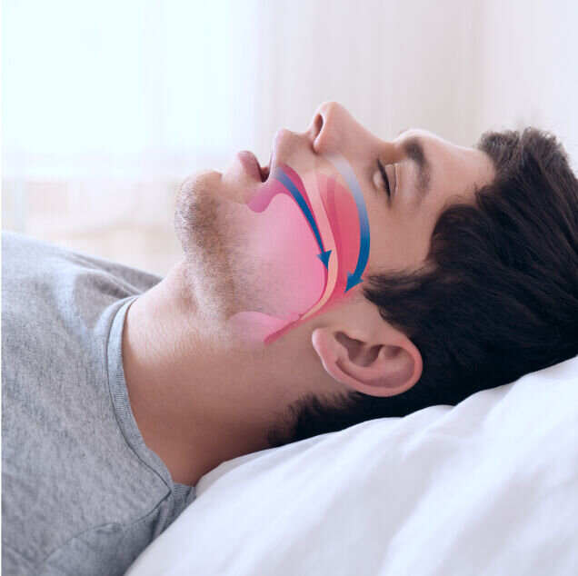 SleepZee image